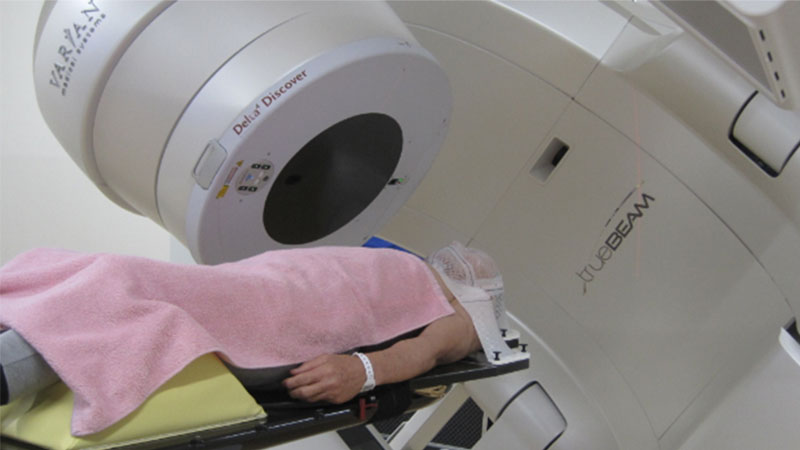 Delta4 Discover patient Ehime